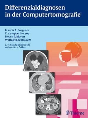 Buchcover Differnzialdiagnosen in der Computertomografie Buchcover Differnzialdiagnosen in der Computertomografie - Thieme Verlag