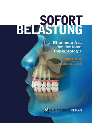 Sofortbelastung Sofortbelastung