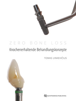 Knochenerhaltende Behandlungskonzepte Knochenerhaltende Behandlungskonzepte